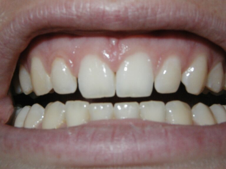 stockvault teeth96490 1