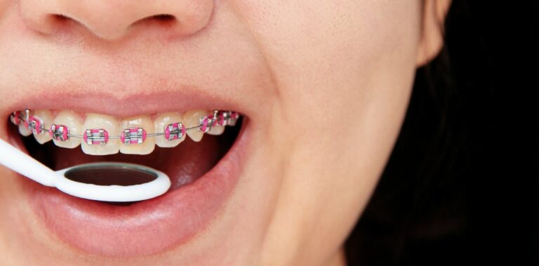 apparecchio fisso o mobile 1