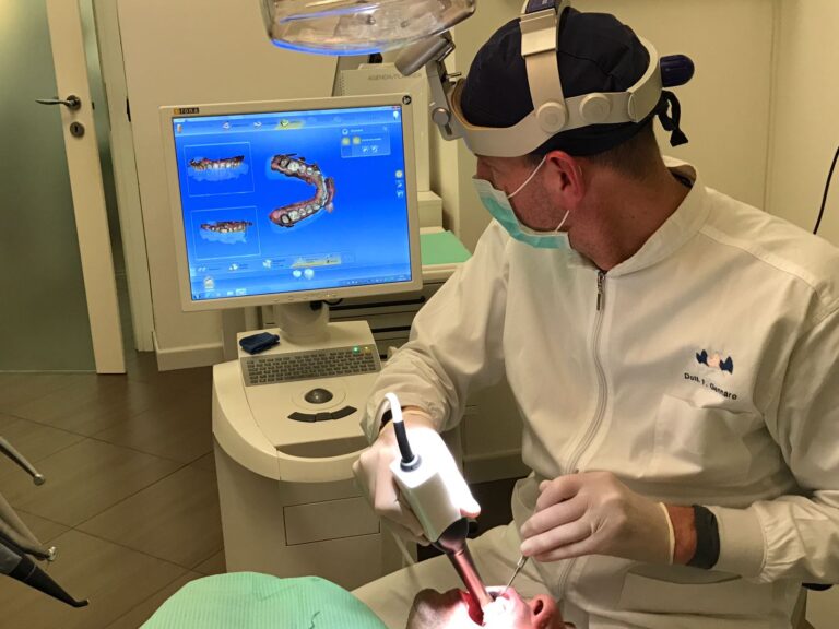 impronta dentale digitale con scanner intraorale 1