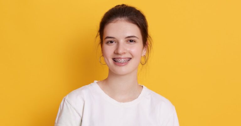 apparecchio dentale 1