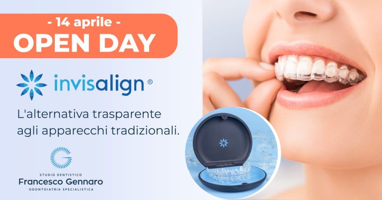 invisalign gennaro 02 2