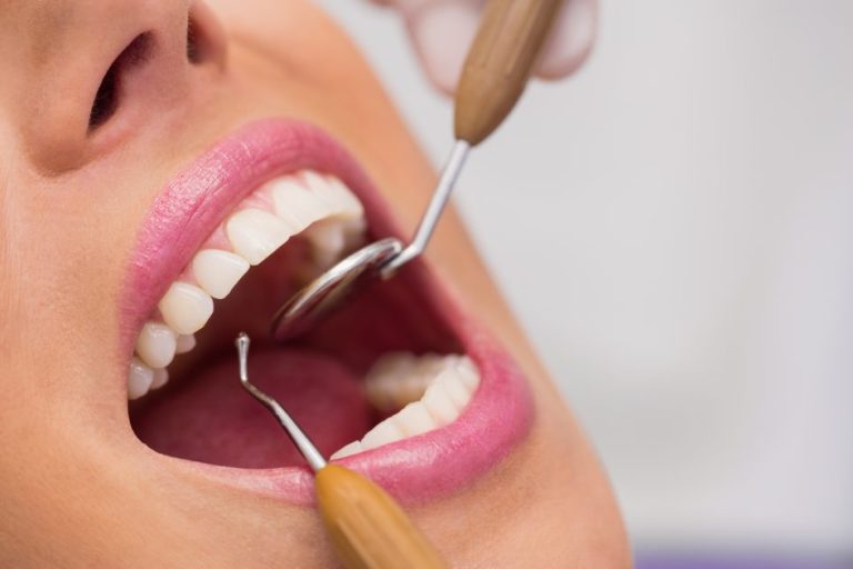 carie dentista palermo