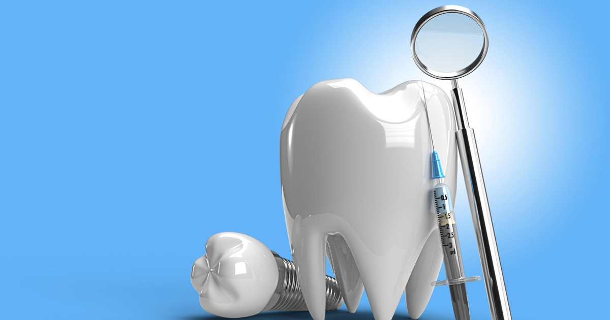 le fasi dellimpianto dentale studio dentistico gennaro