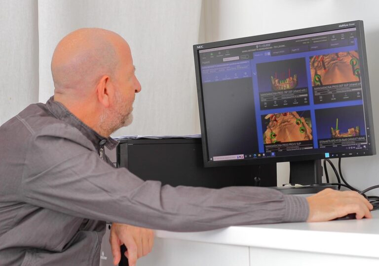 implantologia carico immediato